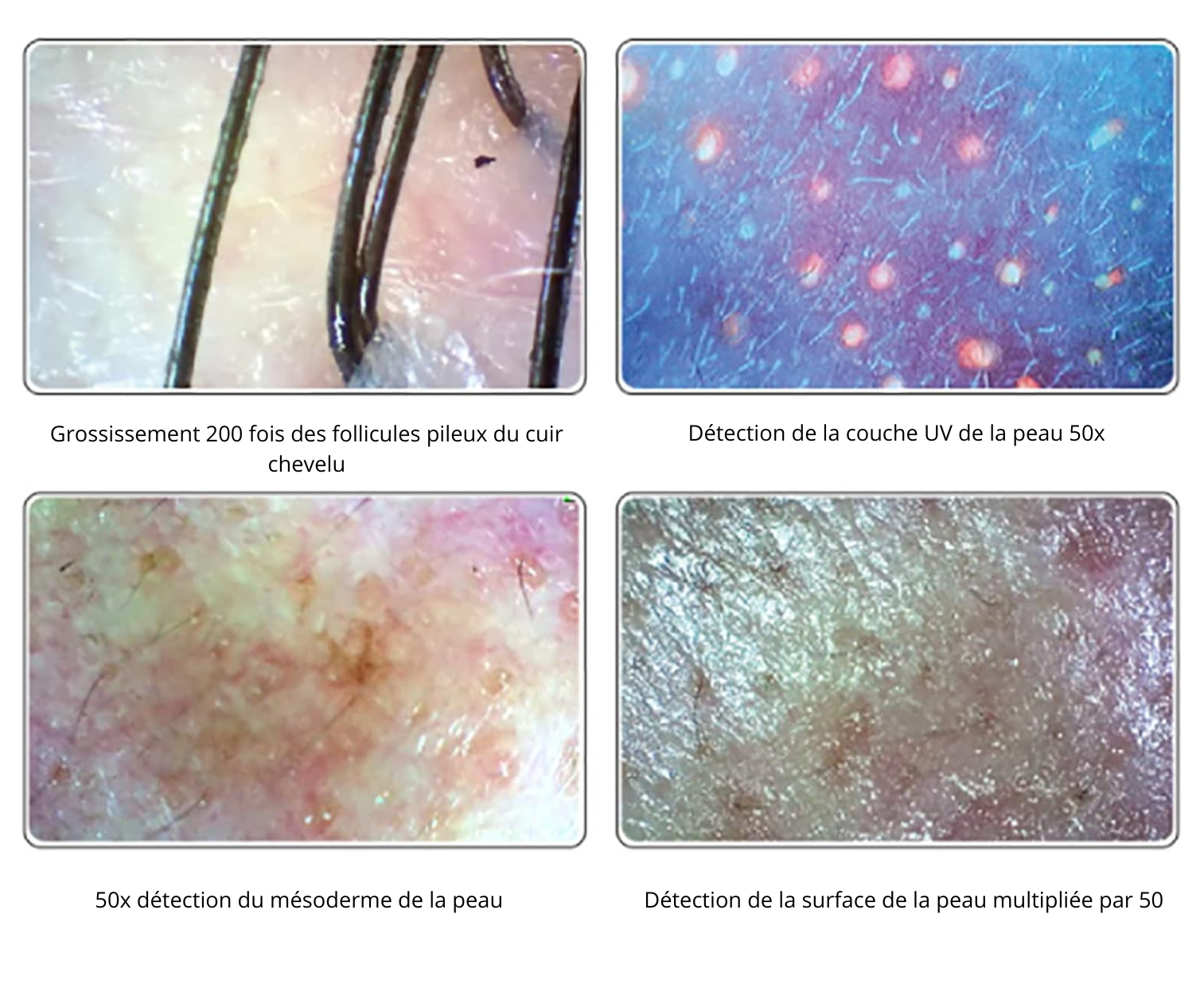 Auréa Vision - Analyseur Head Spa & Diagnostic Capillaire